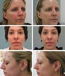 Jan marini skin research, inc. Review Jan Marini Skin Care Management System Skincare Market