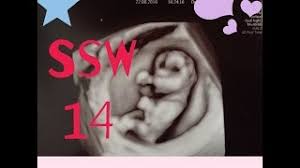 Dies ist ein allmählicher prozess und erst ab ungefähr woche 11 wird es möglich, überhaupt einen unterschied zwischen den geschlechtern zu erkennen. Ssw 14 Ultraschall Junge Oder Madchen Schwangerschaftswoche Vlog 9 Youtube