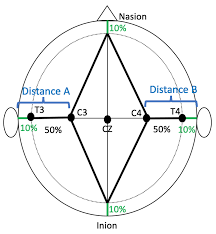 Brain Sciences Free Full Text Electrode Placement In