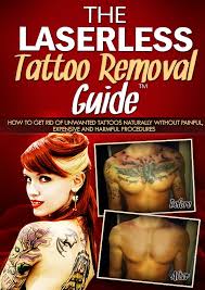 The global tattoo removal market is projected to reach $795 million by 2027, according to allied market research. Tattoo Removal In Ireland Home Facebook