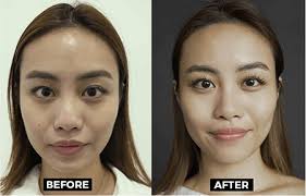 ONLY Home l Aesthetic Treatments In The Comfort Of Your Own Home!