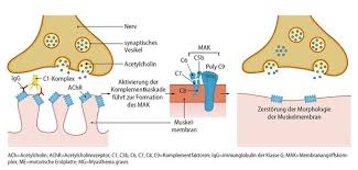 Myasthaenia gravis (mg) is an autoimmune neuromuscular disorder which is twice as common among women, often presenting in the second and third decades of life. Welche Bedeutung Hat Das Komplementsystem