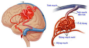 Đột quỵ (tai biến mạch máu não) là tình trạng não bộ bị tổn thương nghiêm trọng, xảy ra khi dòng máu cung cấp cho não bị tắc nghẽn, giảm đáng kể hoặc có một mạch máu trong não bị vỡ. Ä'á»™t Quá»µ Nao Khong Chá»«a 1 Ai 2 6 Thá»§ Pháº¡m Gay Bá»‡nh La Thu Vui Ä'á»™c Háº¡i Cá»§a Nhiá»u NgÆ°á»i Viá»‡t