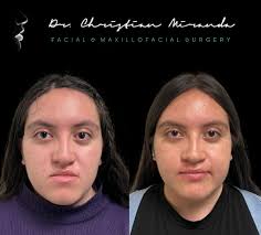 Photos by 🇲🇽Dr. Christian Miranda Lozada (@dr_christian_milo_) · August  21, 2025