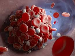 They found that for arterial events. Groups Find Possible Link Between Astrazeneca Covid Vaccine Blood Clots Cidrap