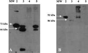 Maka akan diperlukan alamat untuk mengetahui jika seseorang ingin mengirim sesuatu ke rumah tersebut. Ratios Of Activated Matrix Metalloproteinase 9 To Tissue Inhibitor Of Matrix Metalloproteinase 1 In Wound Fluids Are Inversely Correlated With Healing Of Pressure Ulcers Ladwig 2002 Wound Repair And Regeneration Wiley Online Library