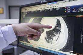 Ct Scans Might Offer A More Accurate Way To Diagnose Covid 19 Stat