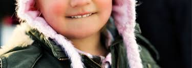 Complete heterochromia is when they have two different colored eyes, the explanation reads. What Causes Different Colored Eyes