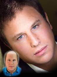 Client Gallery Hair Replacement For Men And Women Ja Alternatives The Fine Art Of Hair Replacement Hair Replacement For Men Hair Replacement Hair