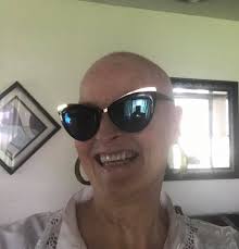 My friend told me that bald is in as long as you wear big glasses and big  earrings! 😀 Okay all you donut fiends