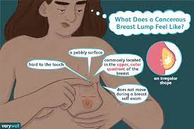 Most breast cancer symptoms are discovered by women during regular daily activities like bathing. Breast Lumps Cancerous Vs Noncancerous