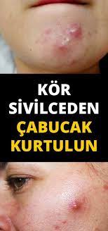 Pin By Jamila Rzali On Tuyo Skin Care Skin Beauty Skin