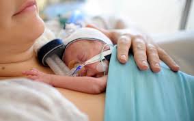 Image result for Preterm Infant Growth