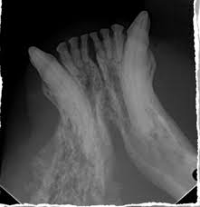 12 warning signs of cancer in cats. Oral Squamous Cell Carcinoma In Cats
