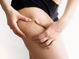 How to tell the difference between fat and bloating, the experts set you straight on how to lose face fat safely. What Is Cellulite Definition Causes And Treatments