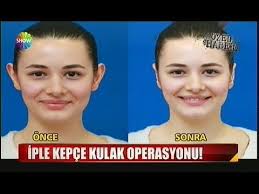 Kepce Kulak Estetigi Landing Vucut Bakimi Cilt Bakimi Saglik