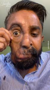 How one prosthetic eye changed his life 👁️🌟 #storytime #powerfulstory  #prosthetic #fyp