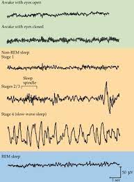 Integrative Neuroscience Neuroscience Sleep Medicine Brain Waves