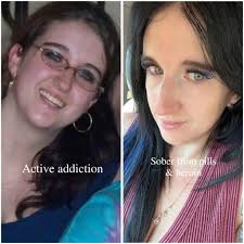 Personal story of addiction recovery and support