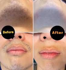 揾考試model 半永久漸變唇7月31號6點至9點有車馬費歡迎聯絡🙏🏻