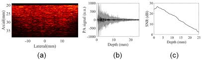 Sensors Free Full Text Multiangle Long Axis Lateral Illumination Photoacoustic Imaging Using Linear Array Transducer Html