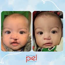 PIEL Asociación Civil Sin Fines de Lucro