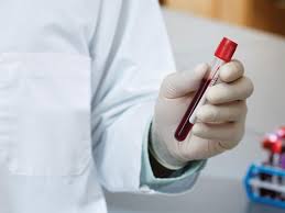 A liver function test is one of a group of tests that check levels of certain enzymes and other proteins in your blood. Enhanced Liver Fibrosis Elf Test