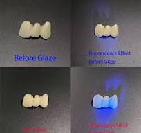 Dental Stain Glaze Paste Kit Diluent Liquid Refreshing Liquid Stain Low  Temperature Glaze For Zirconia Full Crown Staining - AliExpress 66