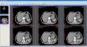 Maybe you would like to learn more about one of these? Sante Dicom Viewer Mac How To Burn Dicom Cd Dvd