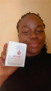 Our Bio Oil winner all the way from the capital city Priscilla Florence  Chirwa you too can be a winner. Look out for this weeks bio Oil  competition. And don't forget this