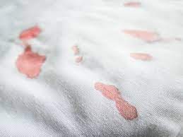 Die badewanne war auch nicht so richtig sauber und zudem mit einer art antirutschfarbe eingepinselt, was auch nicht den aller hygienischsten anschein machte. Blutflecken Entfernen Sofa Jeans Teppich Die Besten Hausmittel Heilpraxis