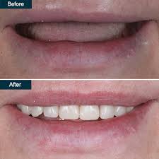 Lumia dental · new york center for cosmetic dentistry. Cosmetic Dentistry Top Rated Cosmetic Dentists In Brooklyn Ny