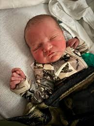 Twins After Reversal Surgery! 👶👶 Reversal babies 2 and 3! Patient age: 38  Tubal ligation type: Tubal clips (clamps) Patient hometown: Grand Island,  New York  [https://www.tubal-reversal.net/testimonials/tubal-clip-reversal-twins-having-babies-2-and-3  ...