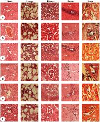 Image result for Anthonotha macrophylla