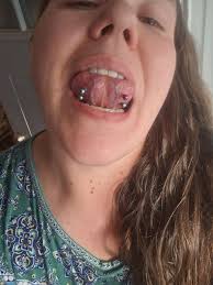 i had my daith done about a month ago and it's still super swollen and it's  getting bumps, it's not painful but a bit itchy. i use saline solution  twice a day