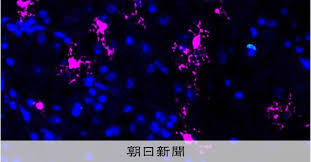 傷ついた脳の回復を持続させる方法を発見 脳梗塞など薬開発に期待
