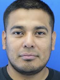 Rhinoplasty Trifecta 6732