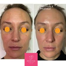 Define by Marie Dolan RGN INP