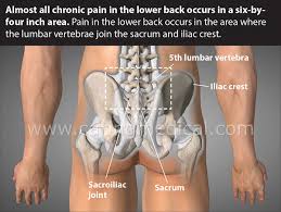 Other pelvic muscles, such as the psoas major and iliacus, serve as flexors of the trunk and thigh at the hip joint and. Prolotherapy For Spinal Instability And Low Back Pain Caring Medical Florida