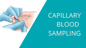 Image result for Capillary Puncture