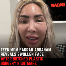 YIKES! #TeenMom star #FarrahAbraham shared photos of her botched plastic  surgery nightmare and blamed a local spa for the disaster. Link below for  details. (📸: YELP) bit.ly/49Aweu3