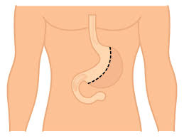 We did not find results for: A Prof Jaber Laparoscopic And Open Gastrectomy