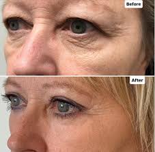 Dr. Babak Maleki, Oculoplastic Surgeon