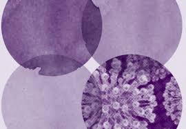 Herpes simplex type 2 is the most frequent cause of neonatal herpes, a very uncommon, but dangerous infection in newborns. Herpes Simplex Virus