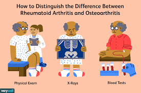 Can You Have Osteoarthritis And Rheumatoid Arthritis
