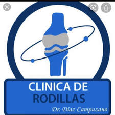 Clínica de Rodillas y Cadera | CDMX - Dr. Díaz Campuzano