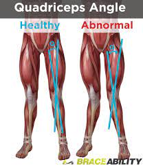 Osgood Schlatter Disease Treatment Exercises Surgery