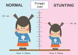 Stunting terhadap anak telah menjadi salah satu indikator global baiknya perkembangan anak. Penyebab Ciri Ciri Dan Dampak Stunting Siswapedia