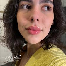 How obsessed are you with these lip filler enhancements this week! Make  sure to book NOW while our late-night appointments are available—we're open  until 8 pm! Head to our bio to secure