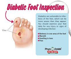 We did not find results for: Pin On Foot Pain